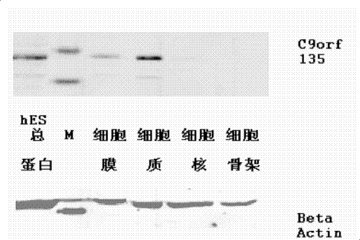 C9ORF135 gene, its encoding protein and application of antibody thereof