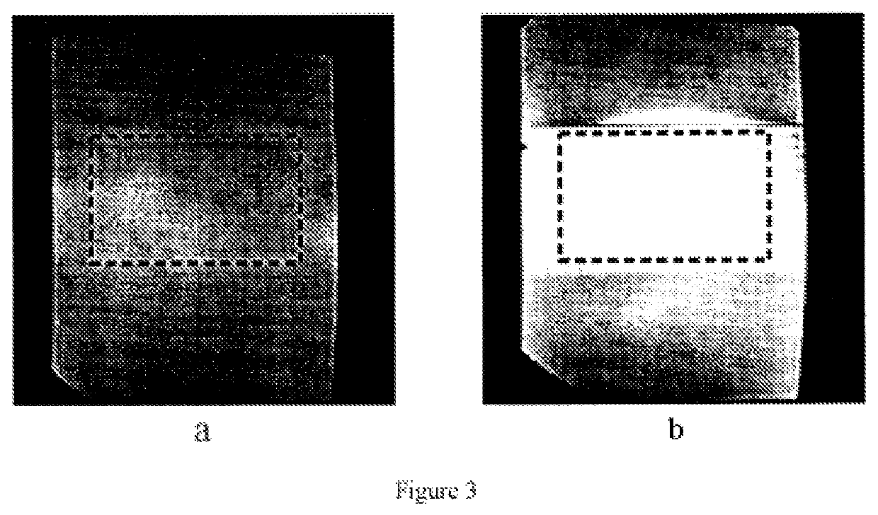 Magnetic resonance imaging machine