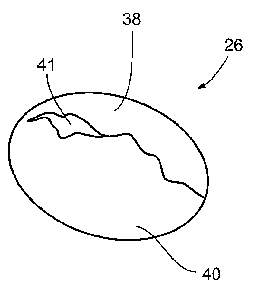 Cardiac valve leaflet augmentation