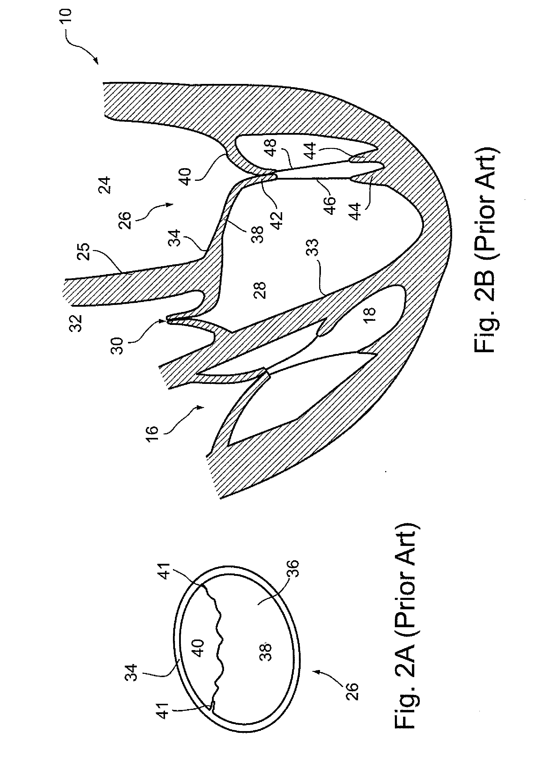 Cardiac valve leaflet augmentation