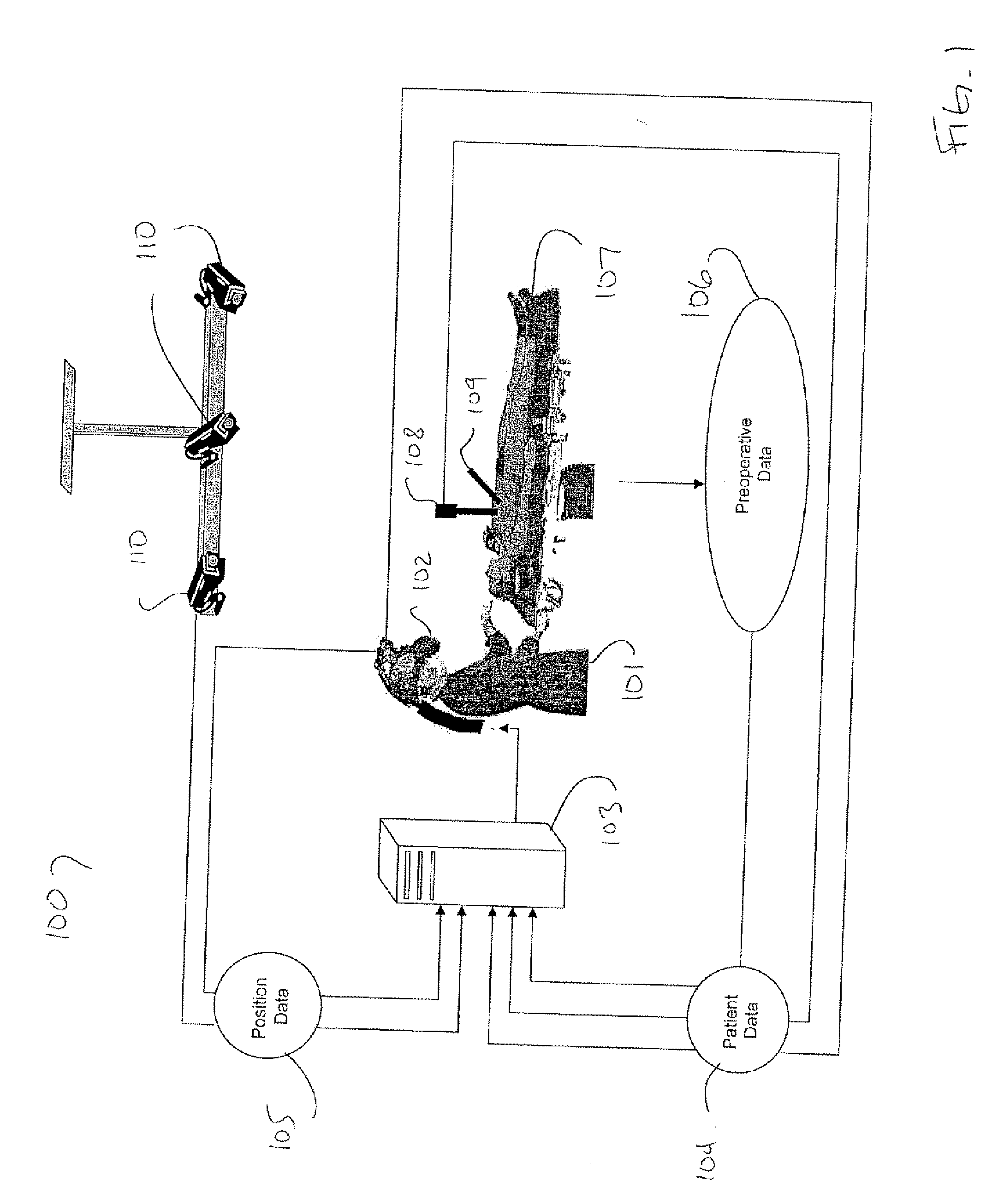 Method and apparatus for minimally invasive surgery using endoscopes