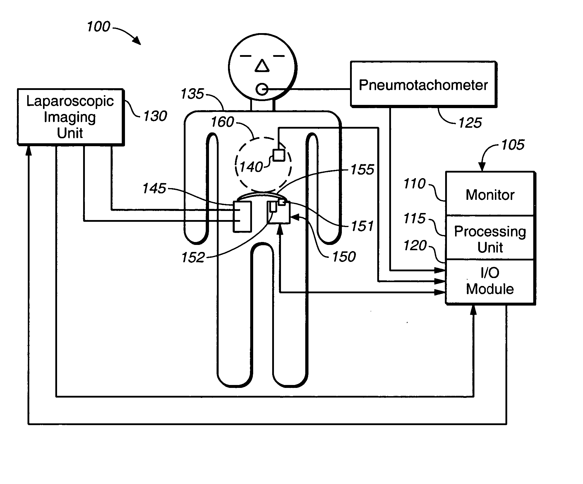 System and method for mapping diaphragm electrode sites