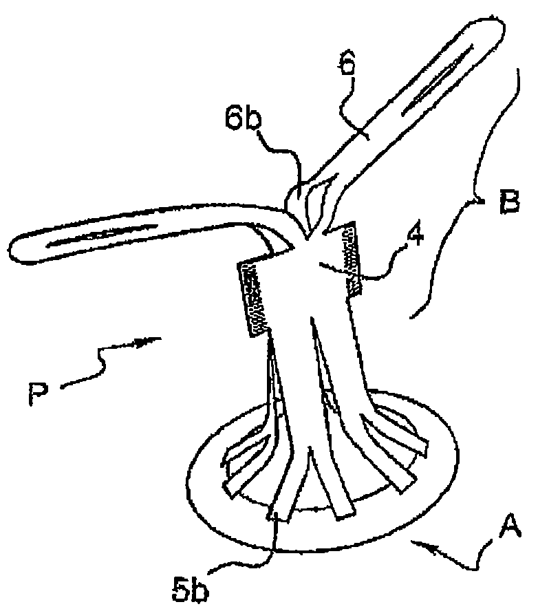 Hernia prosthesis and method for fabricating same