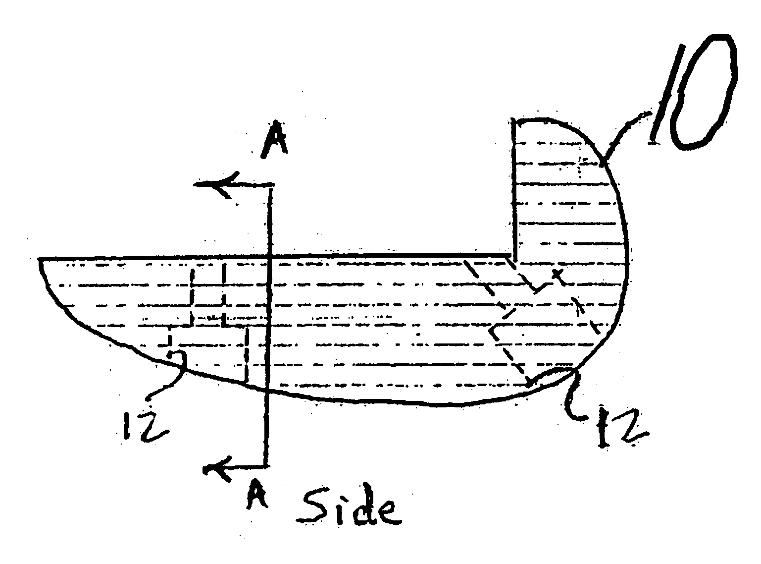 Device and method of arthroscopic knee joint resurfacing