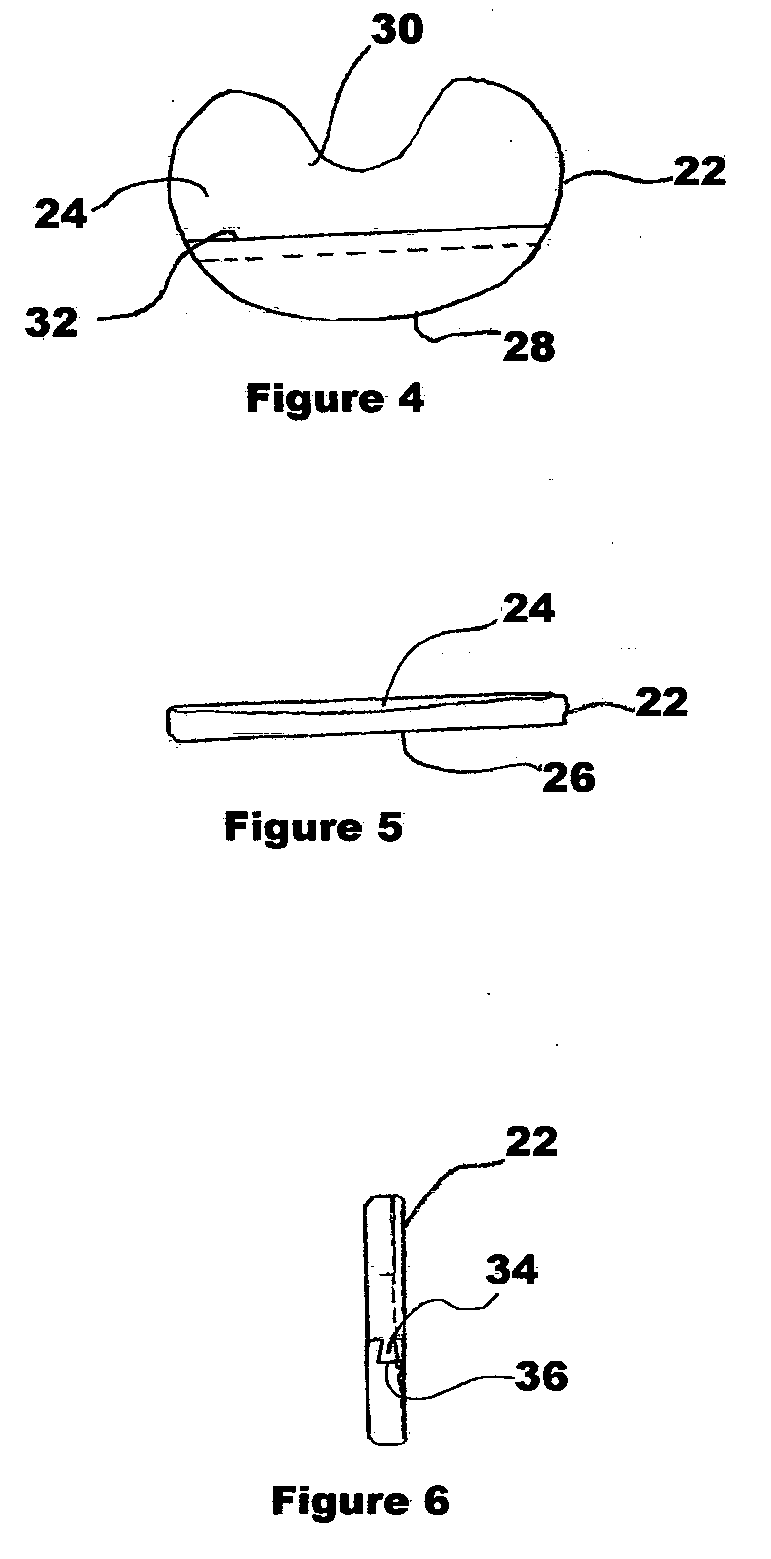 Device and method of arthroscopic knee joint resurfacing