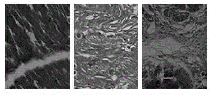 Mesenchymal stem cell injection, as well as preparation method and application in preparing medicament for treating children dilated cardiomyopathy