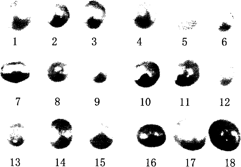 Pearl eosin dyeing method