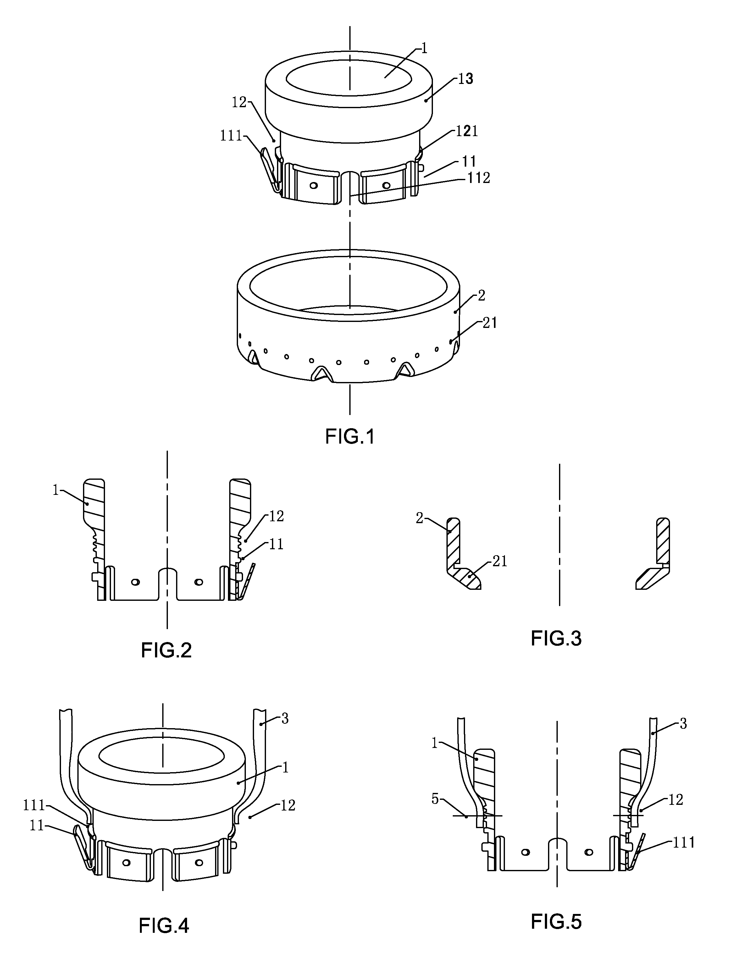 Sleeve type fixing method and device for anastomosis for tubular organs such as intestines, stomach, esophagus etc