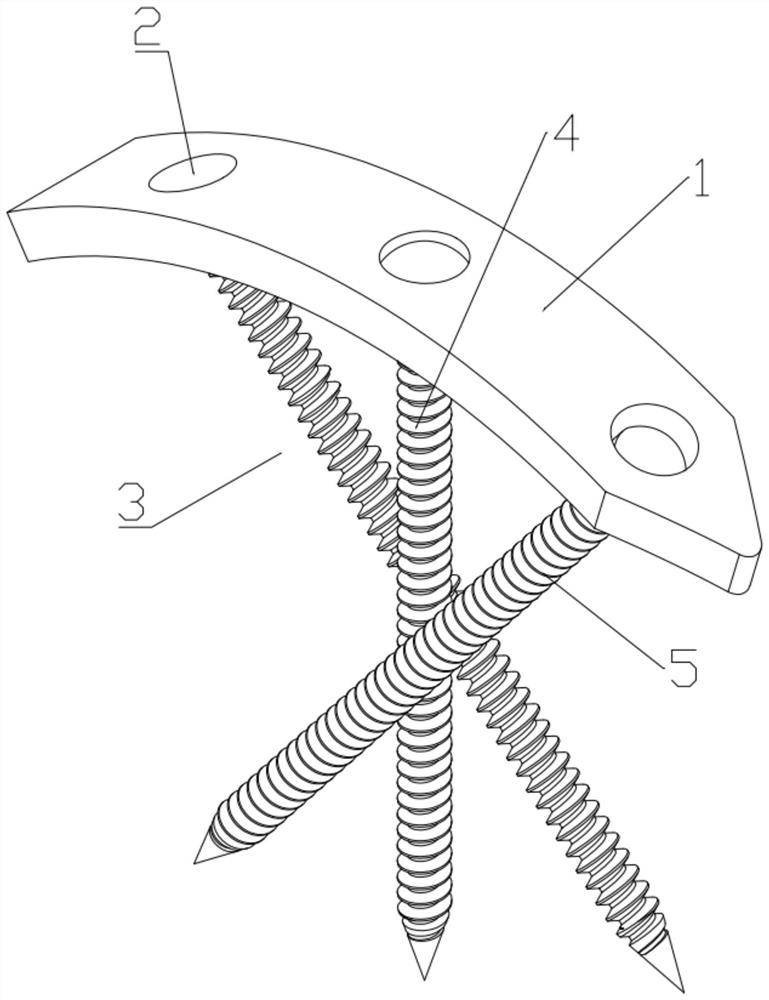 Internal fixing device for calcaneal fracture