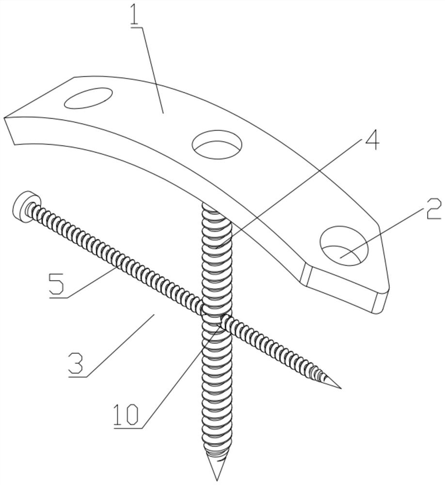 Internal fixing device for calcaneal fracture