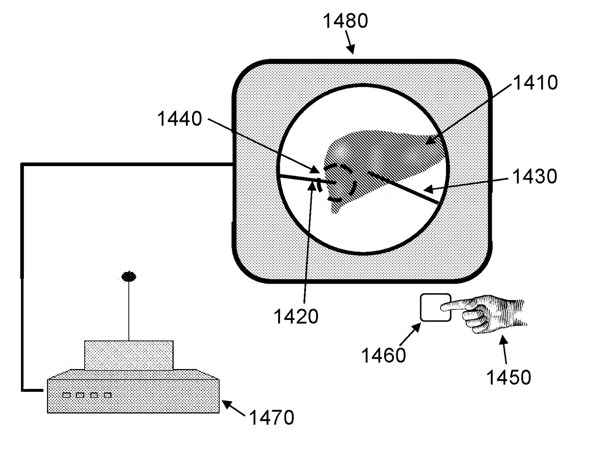 Improved interface for laparoscopic surgeries - movement gestures