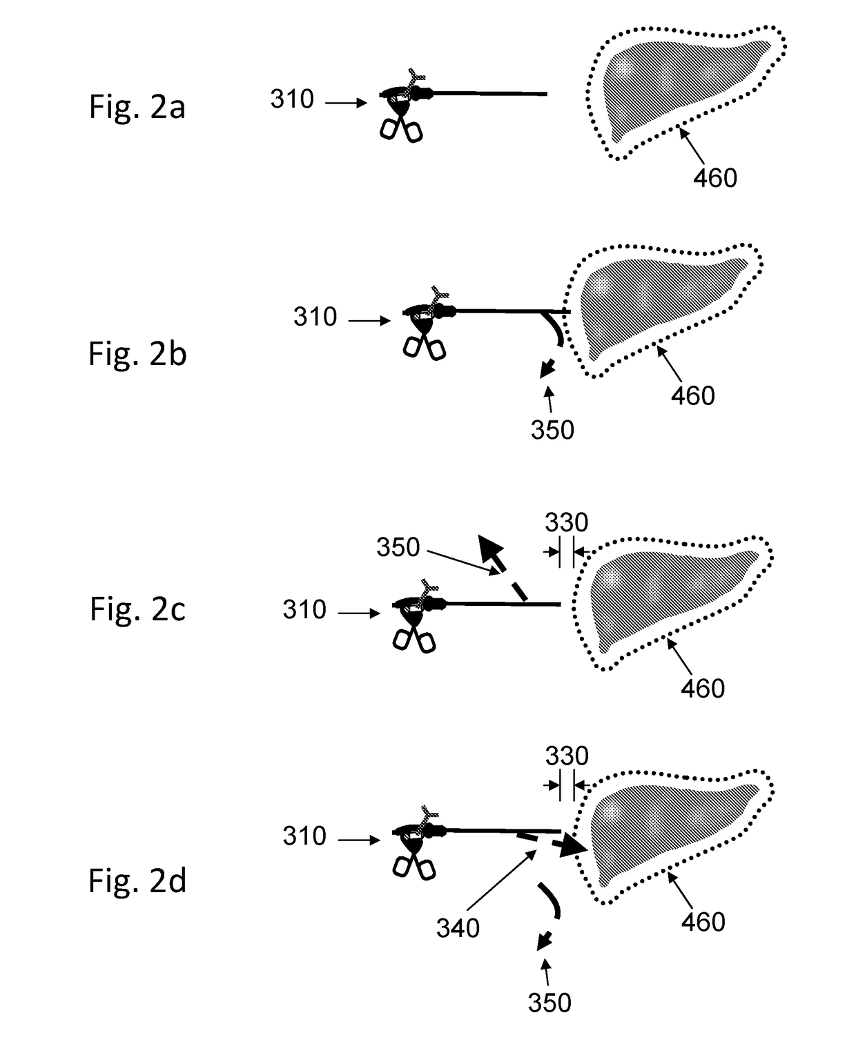 Improved interface for laparoscopic surgeries - movement gestures