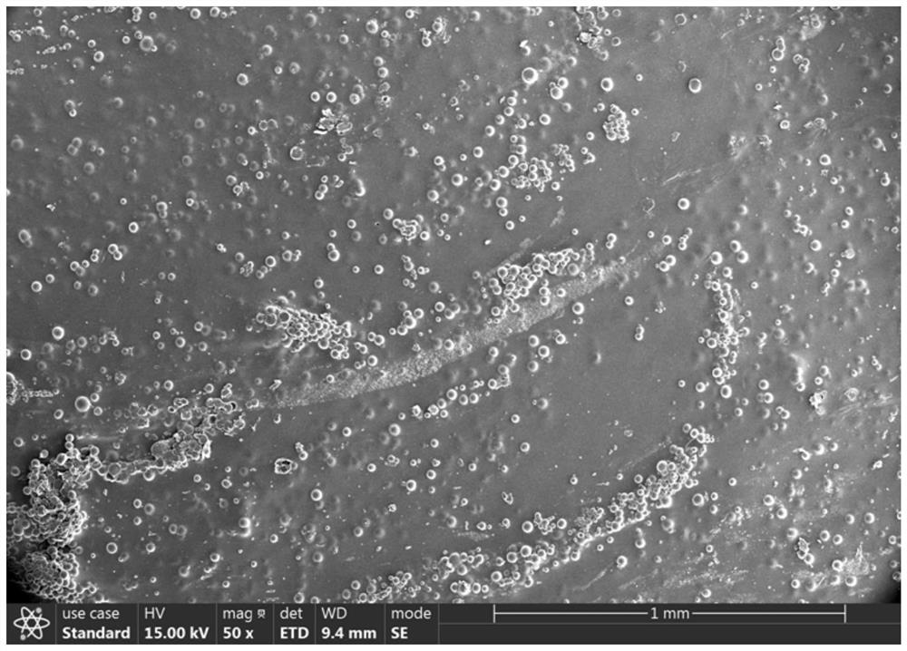 Injection gel composite microsphere and preparation method thereof