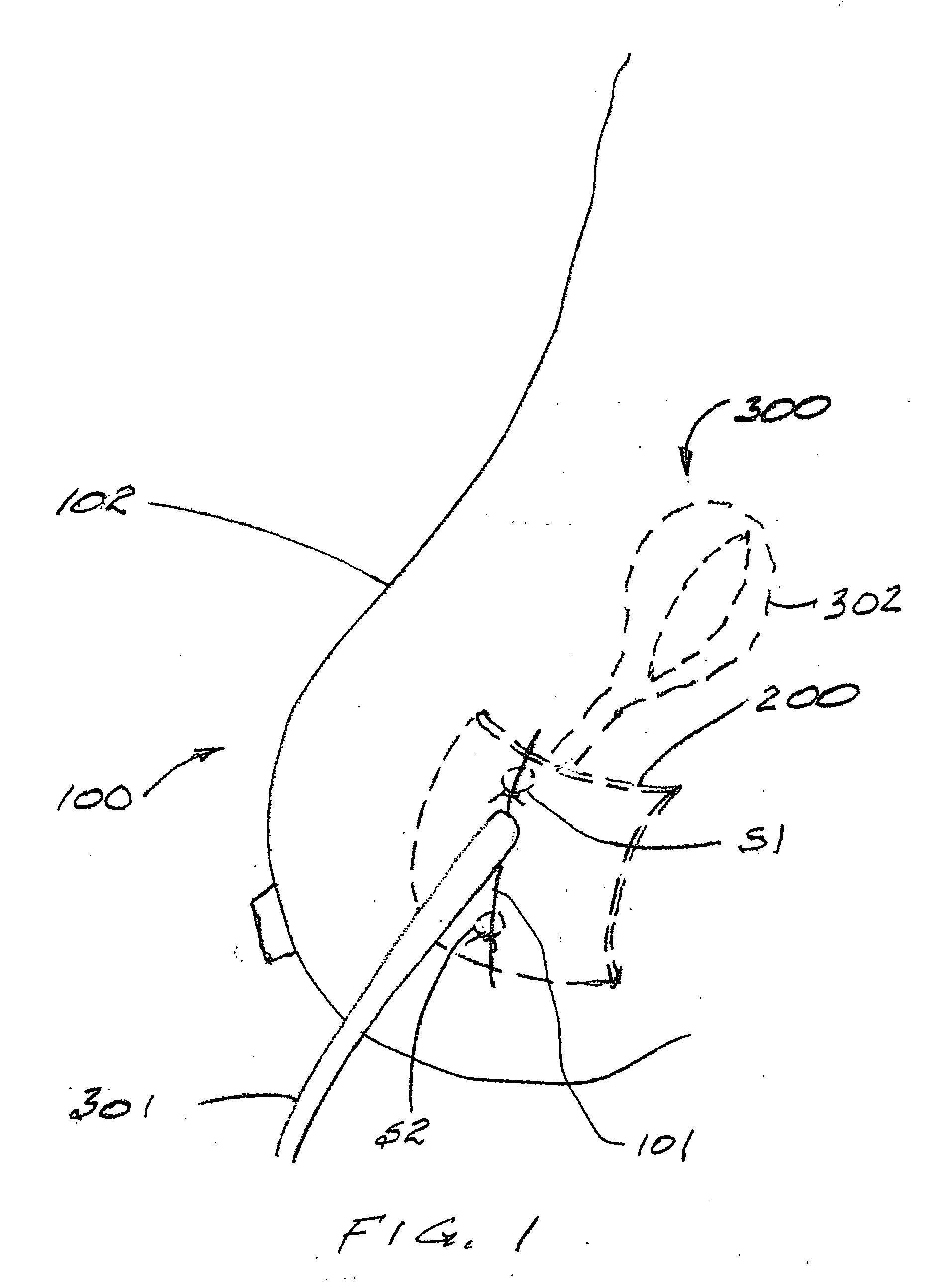 Radiation blocking patch for radio-therapy