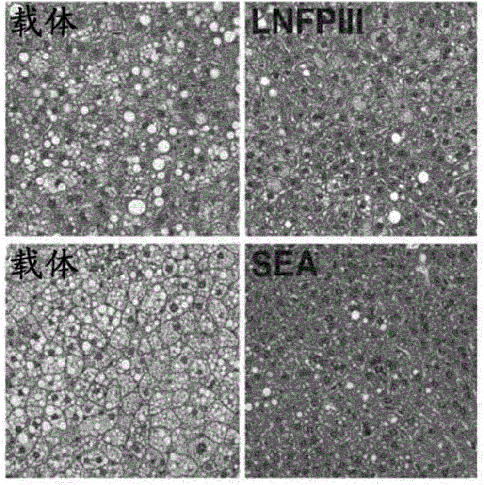 Methods of treating fatty liver disease with helminth-derived glycan-containing compounds