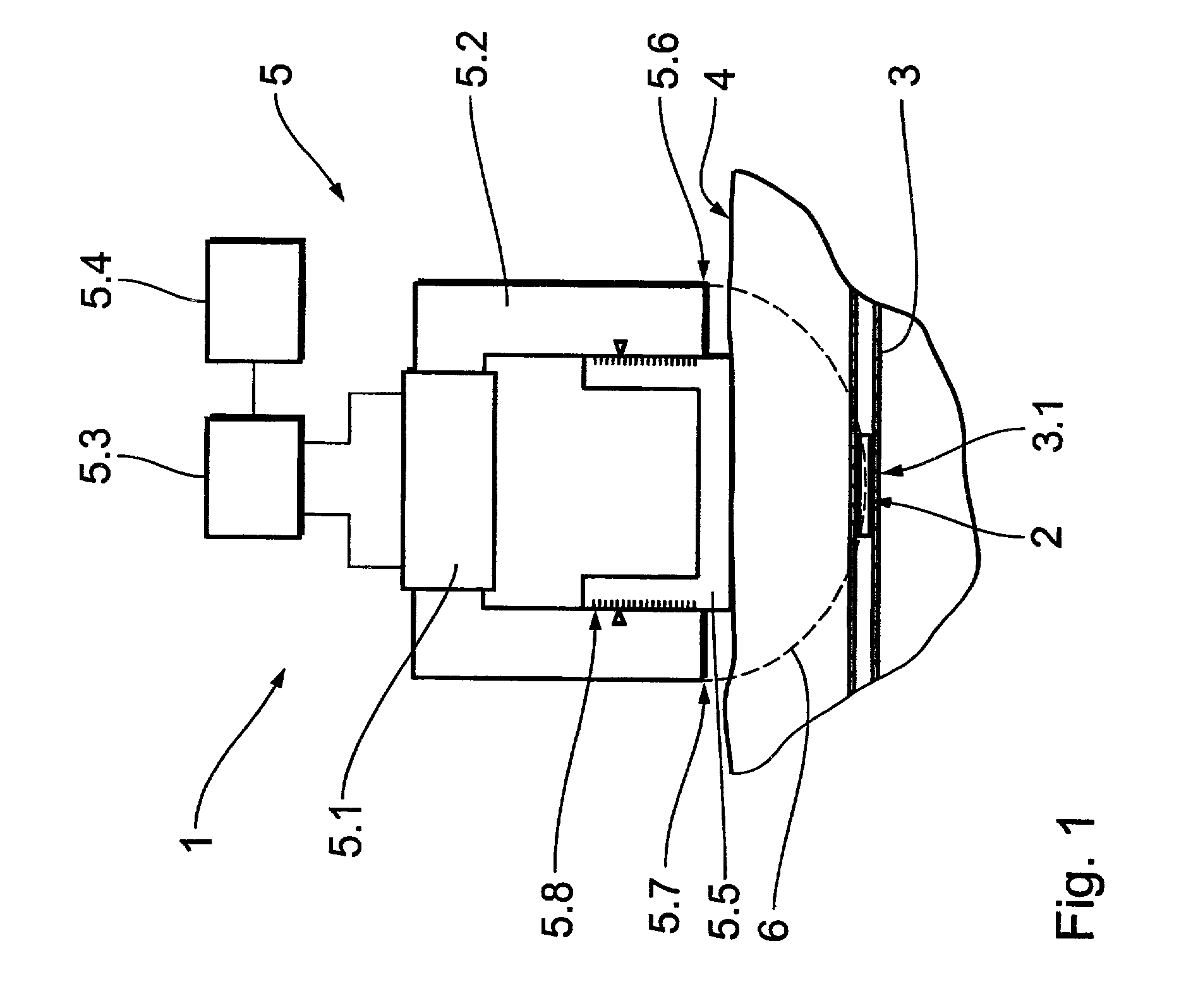 Device for influencing cell-growth mechanisms in vessels of a human or animal body