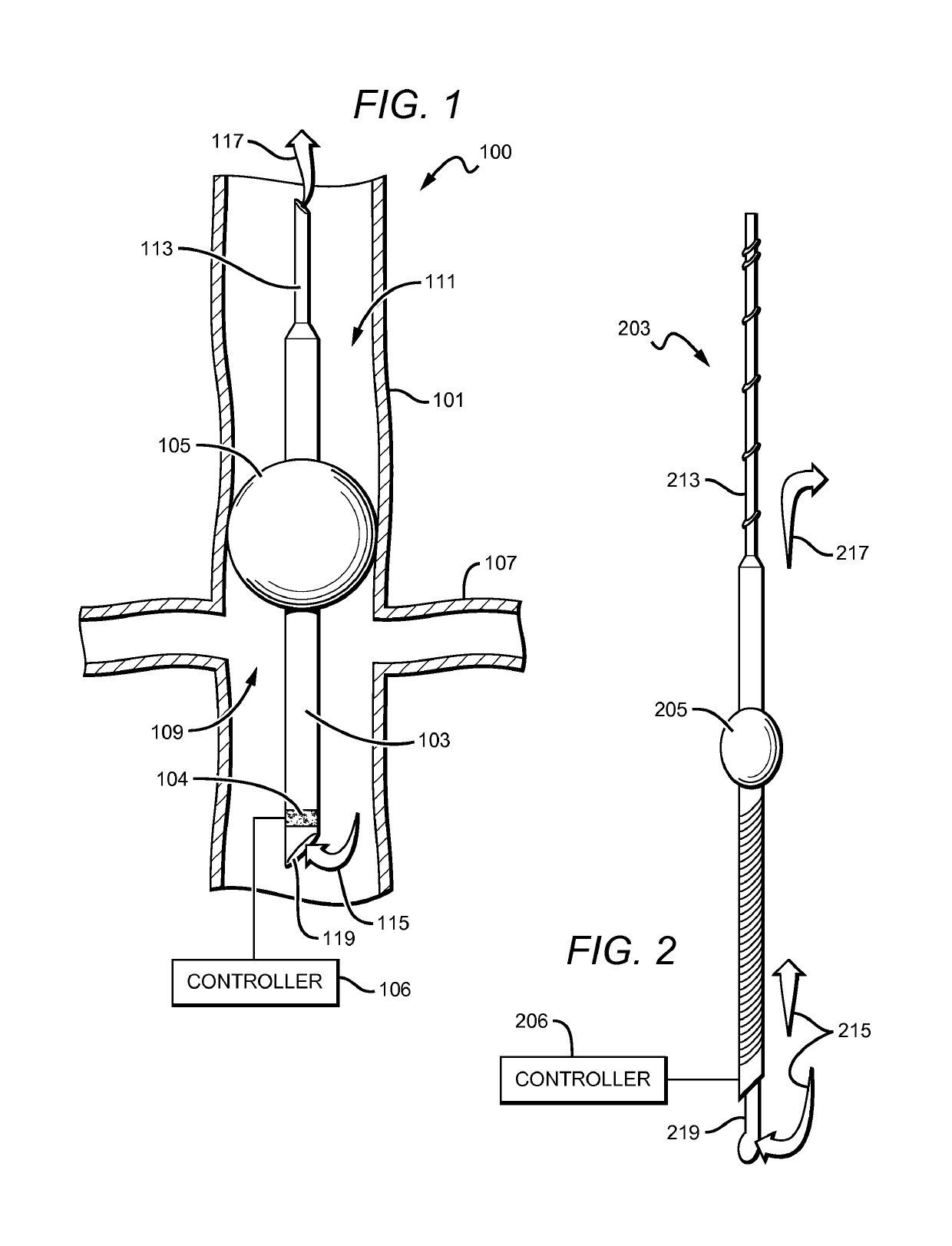 Catheter-based pump for improving organ function