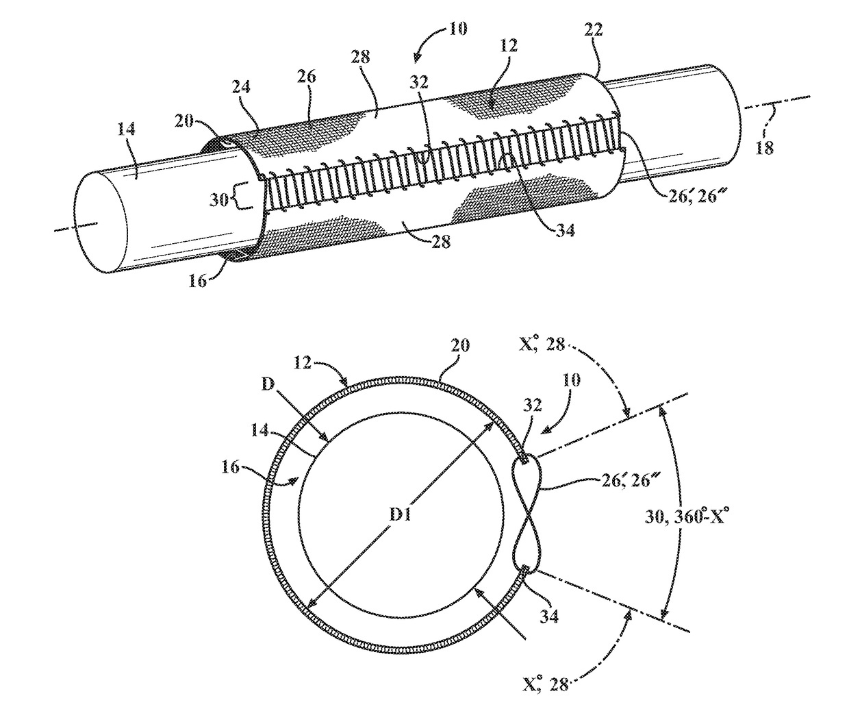 Circumferentially continuous and constrictable textile sleeve and method of construction thereof