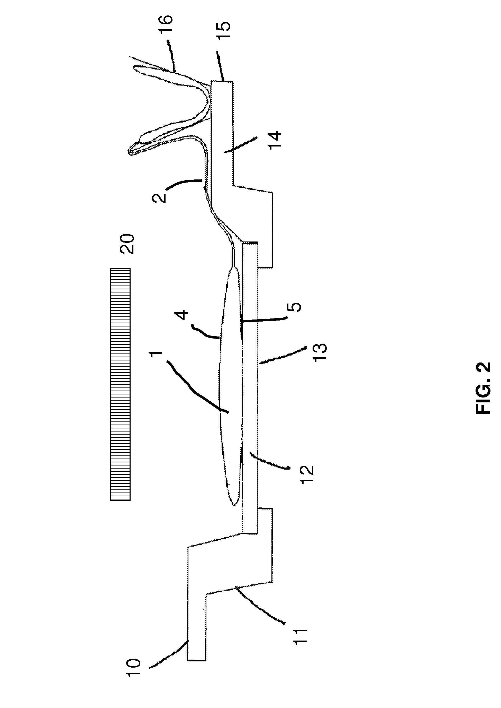 Method for the inactivation of pathogens in donor blood, blood plasma or erythrocyte concentrates in flexible containers under agitation