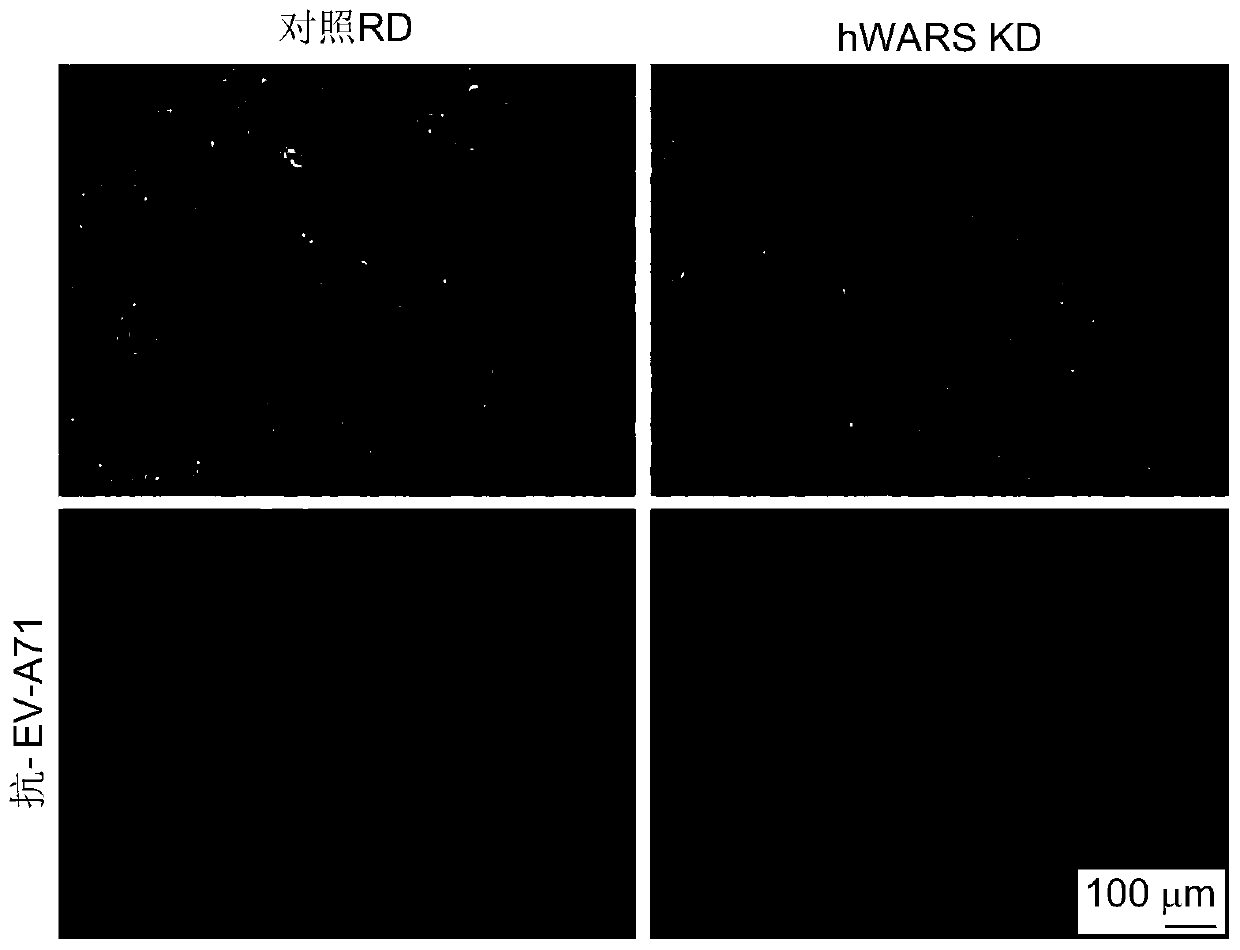 Compositions and methods for treatment of enterovirus infection