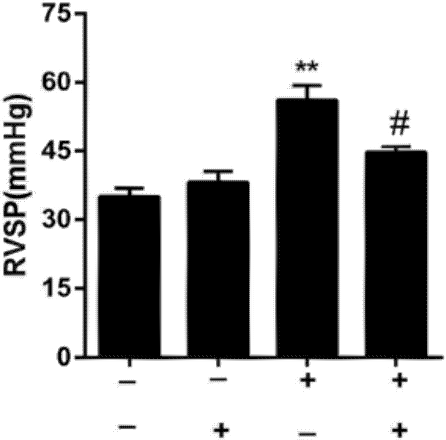 NO (nitric oxide) donor oleanolic acid derivative and preparation method and application thereof