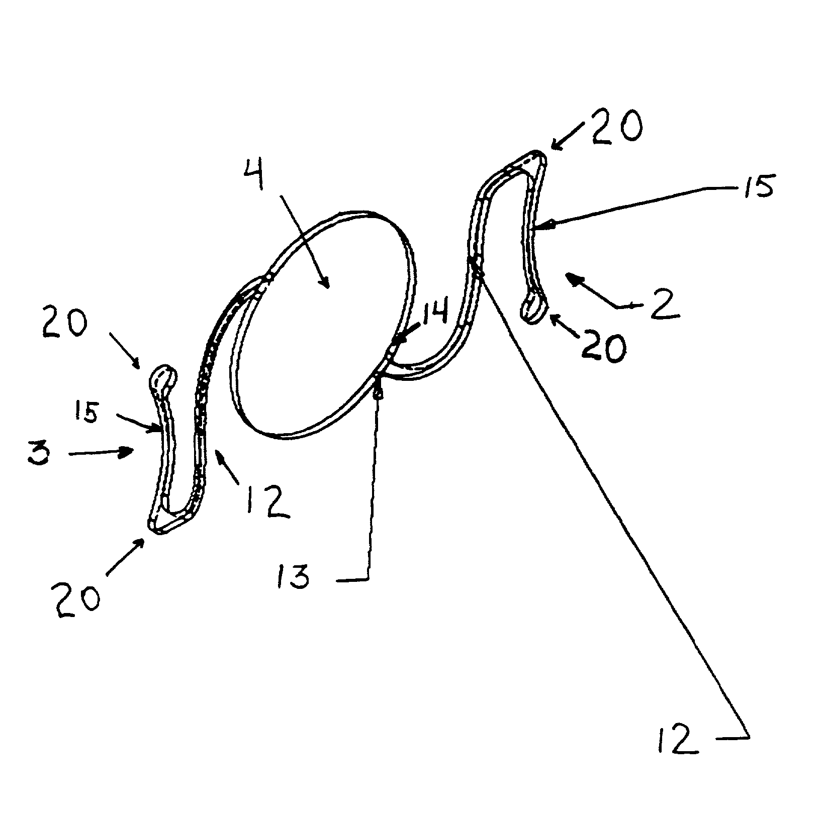 Positive power anterior chamber ocular implant