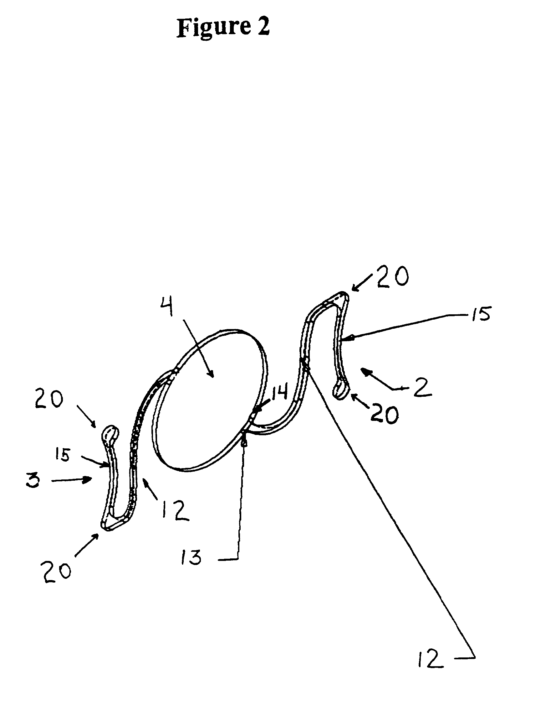 Positive power anterior chamber ocular implant