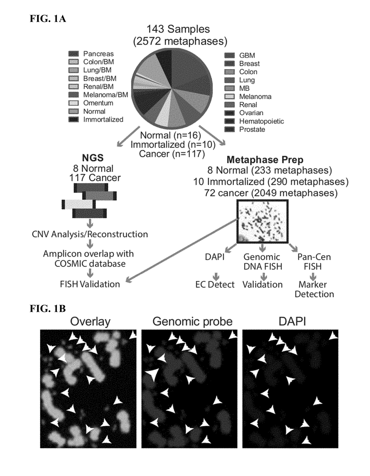 Methods of diagnosing and treating cancer targeting extrachromosomal DNA