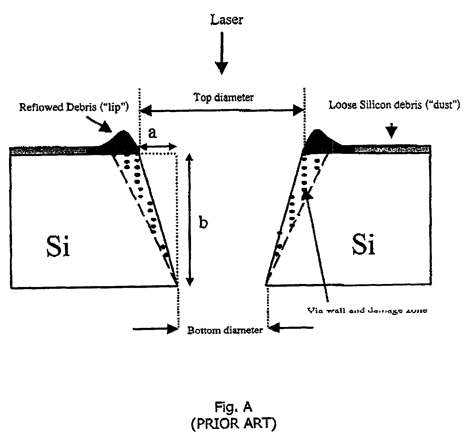 Laser machining system and method