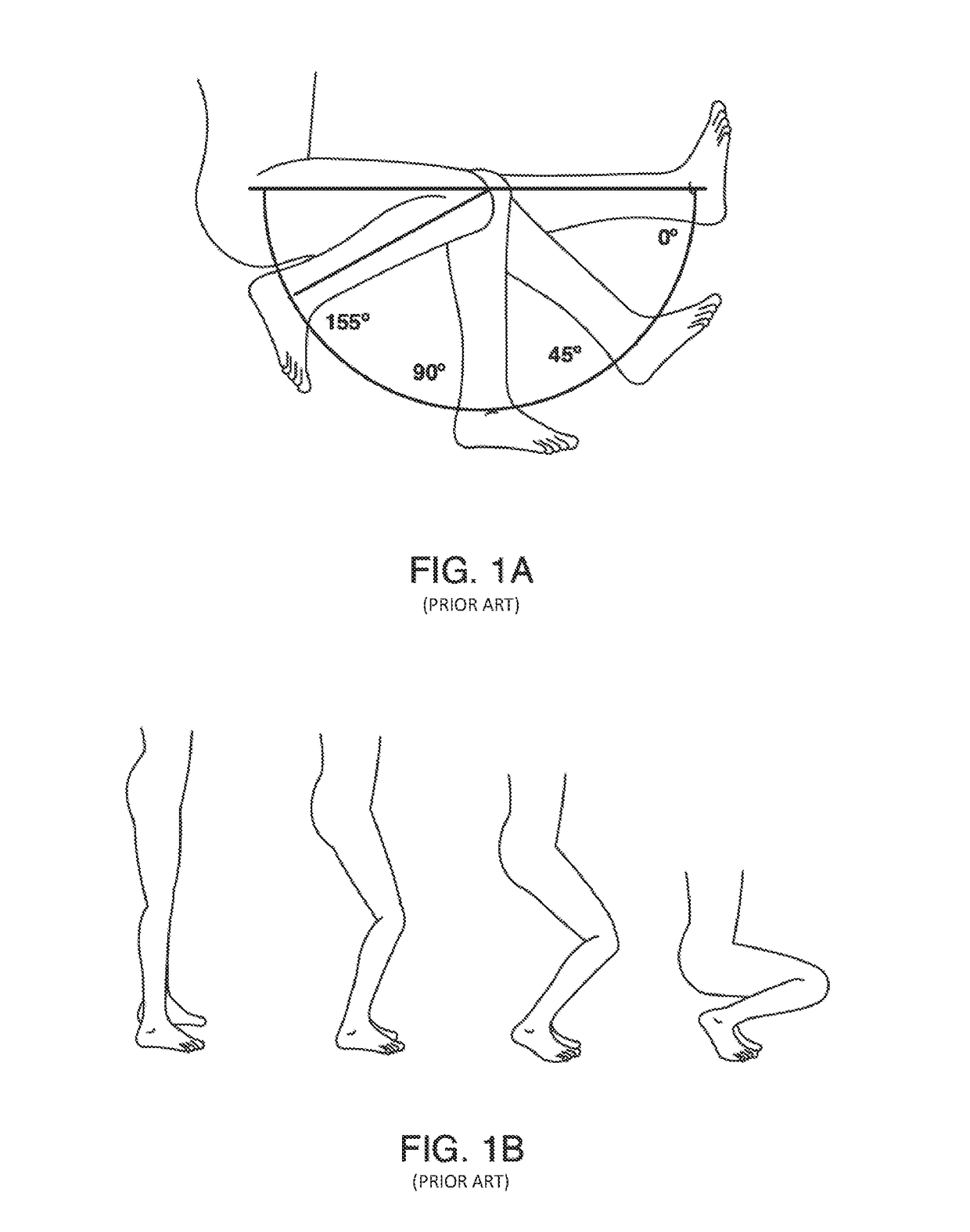 Systems and methods for providing prosthetic components