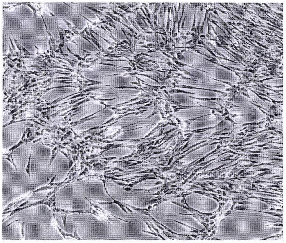 Preparation method of gene editing novel coronavirus vaccine vector