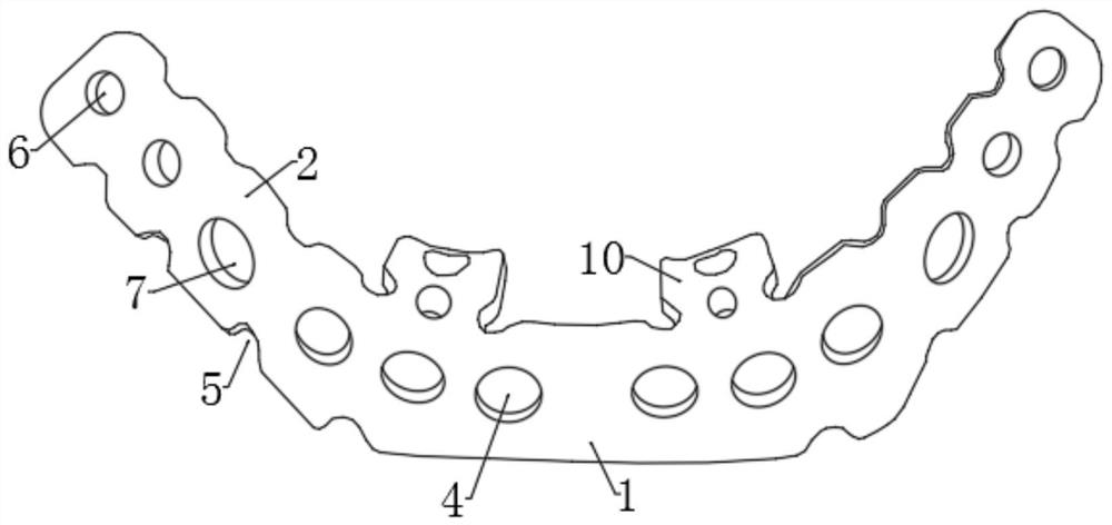 Novel symphysis pubis dissection bone fracture plate and design method thereof