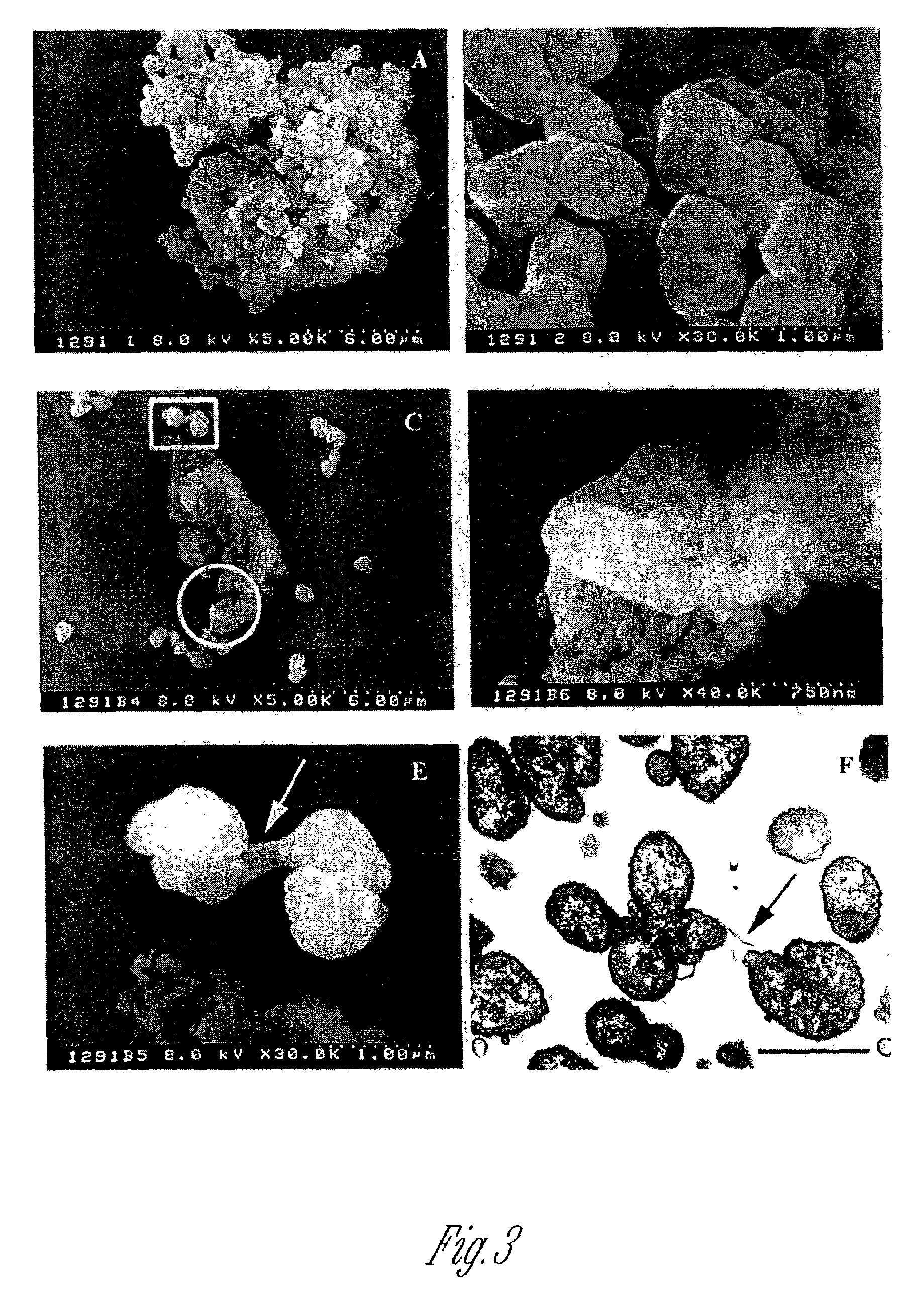 Two-component system that controls bacterial membrane synthesis