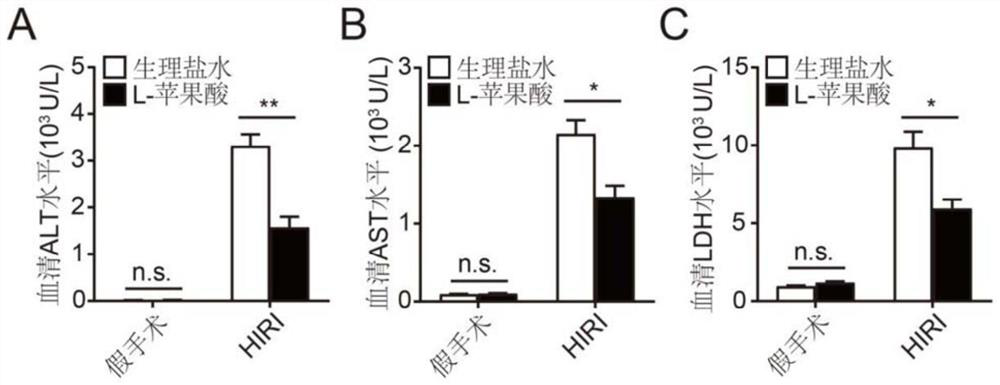 Application of L-malate in preparation of medicine for preventing and treating hepatic ischemia/reperfusion injury