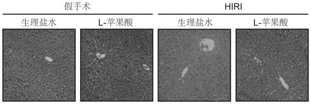 Application of L-malate in preparation of medicine for preventing and treating hepatic ischemia/reperfusion injury