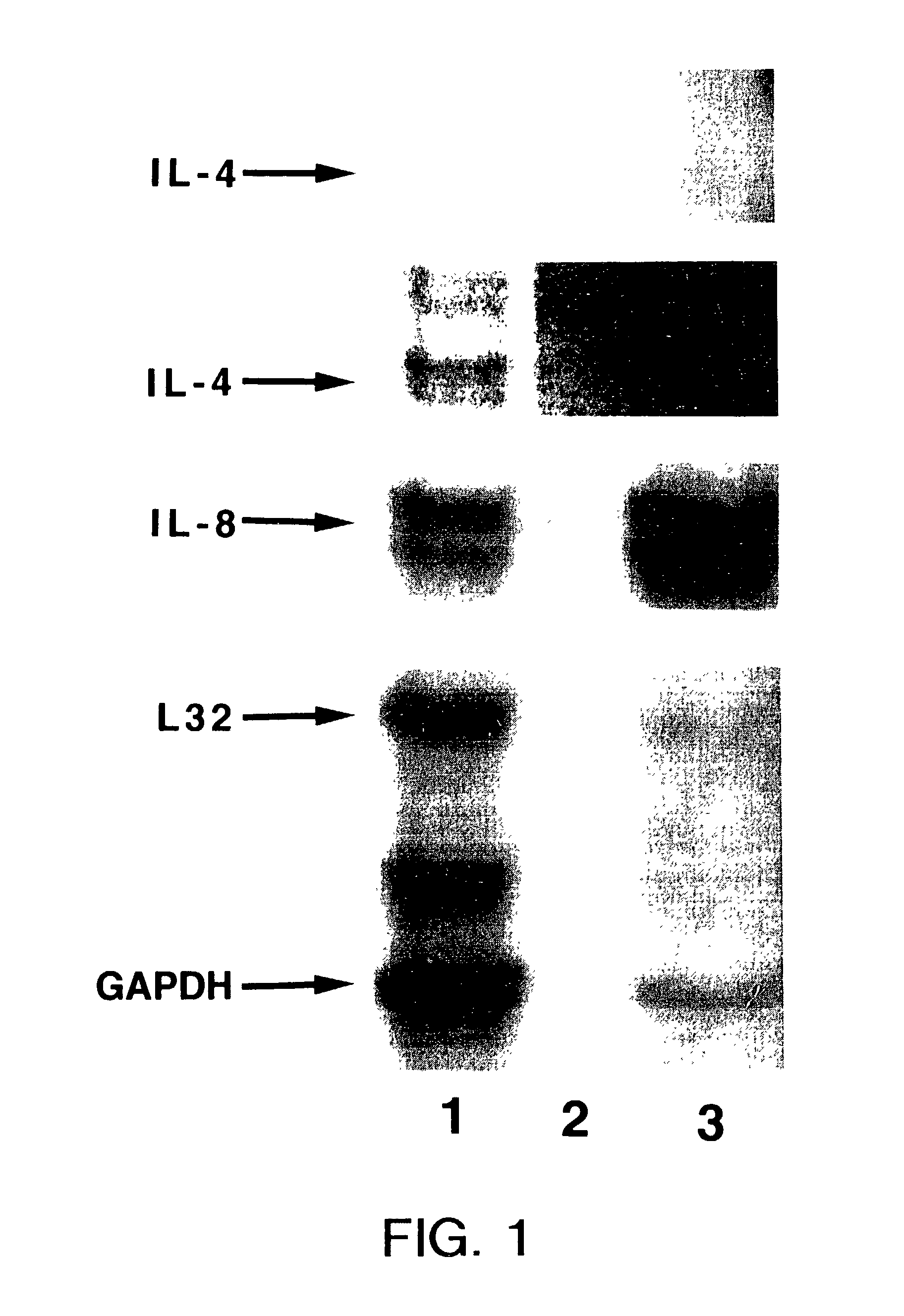 Method for detection of melanoma