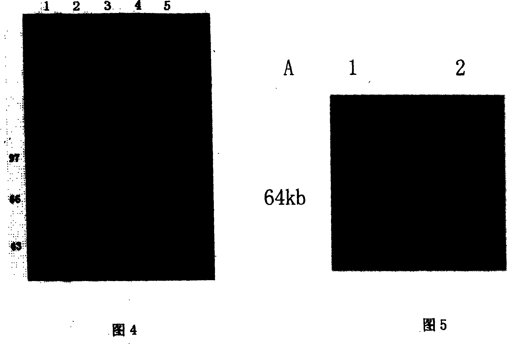 Fusion protein in soluble receptor II - antibody Fc section of human tumor necrosis factor