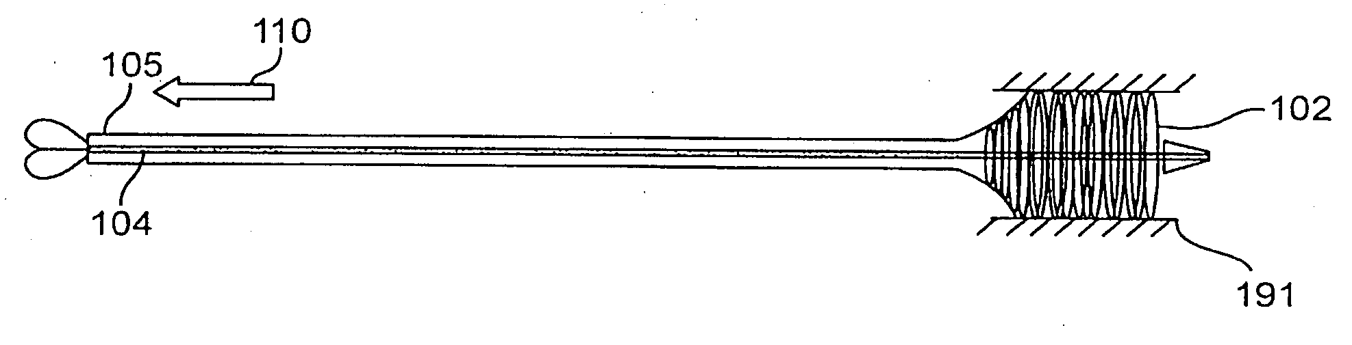 Endoscopic stent delivery system and method