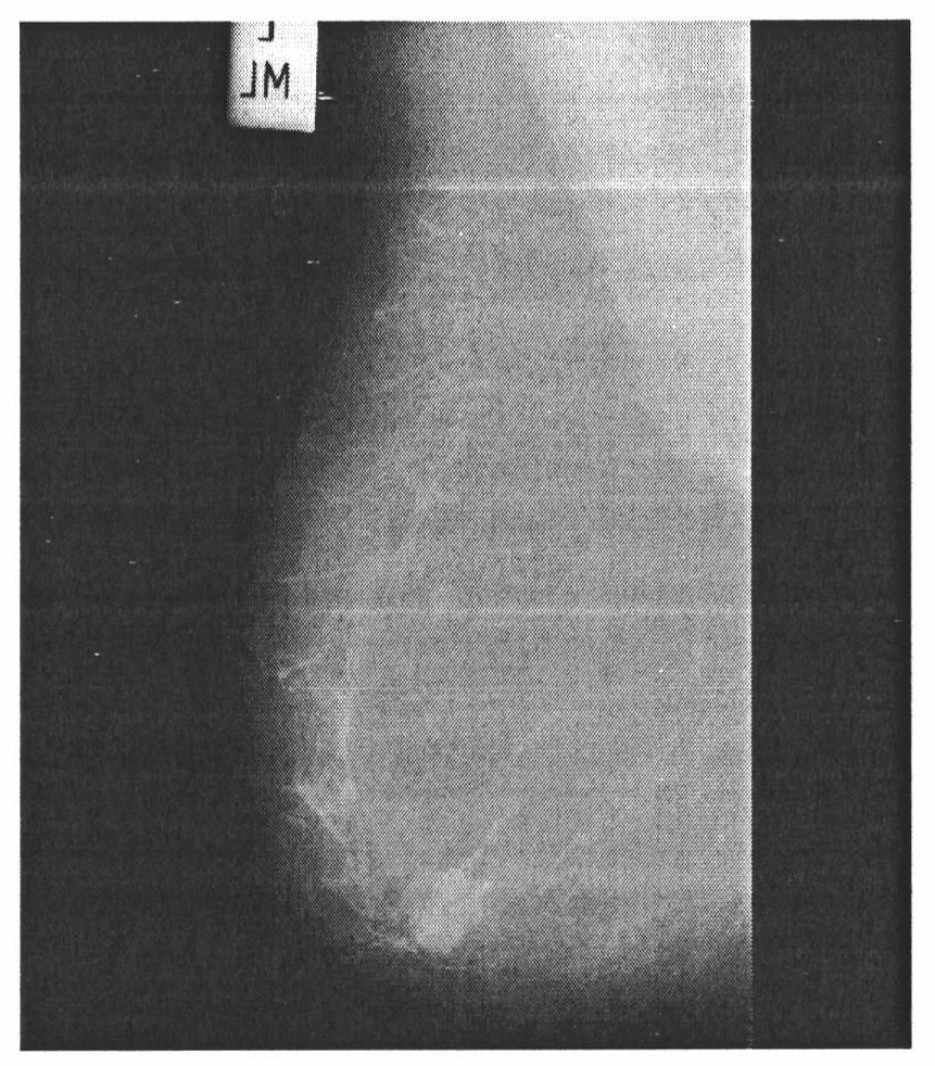 Medical image diagnosing system and diagnosing method based on migrated nuclear matching tracing