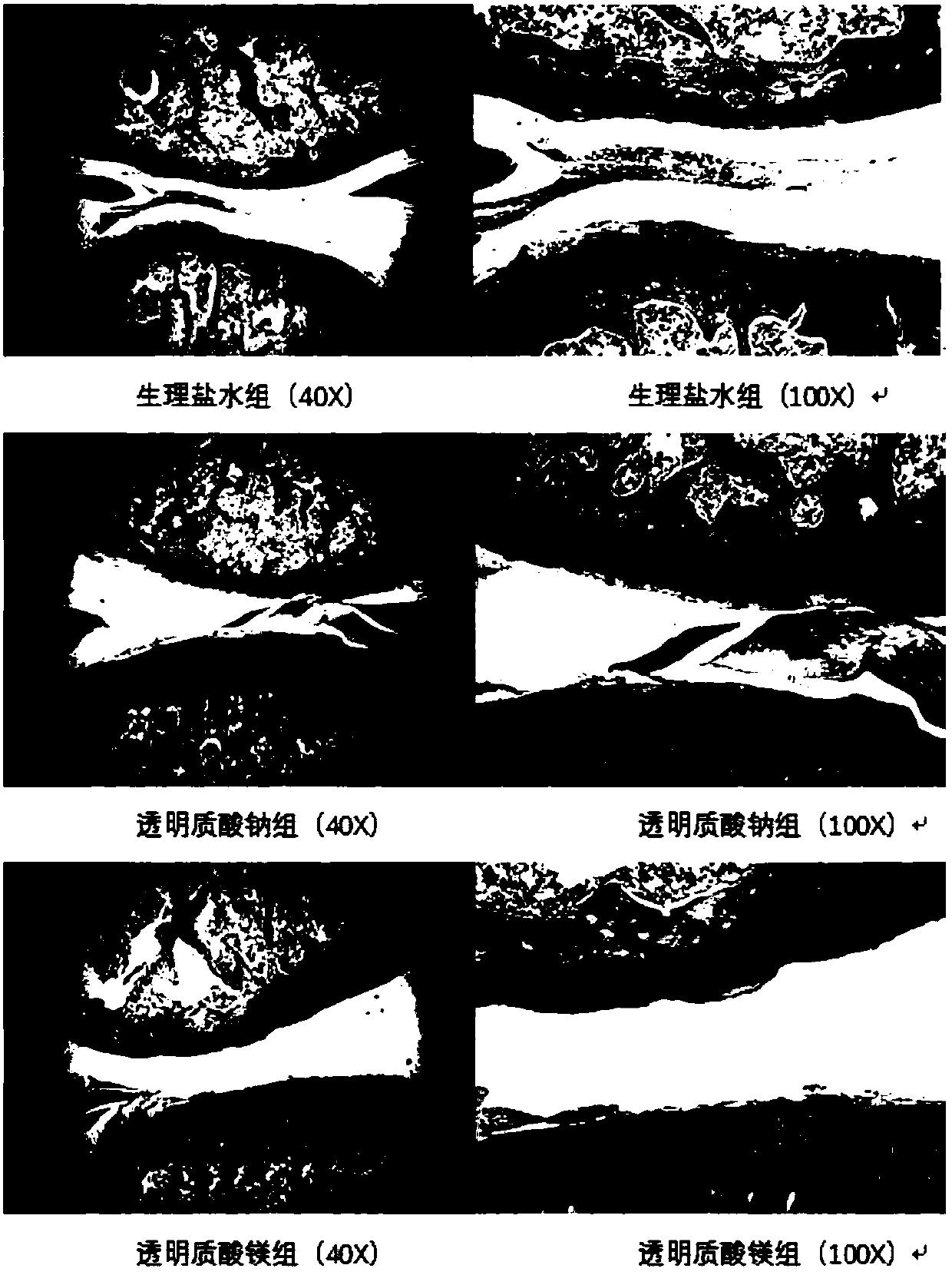 Magnesium hyaluronate for treating osteoarthritis and preparation method and application thereof