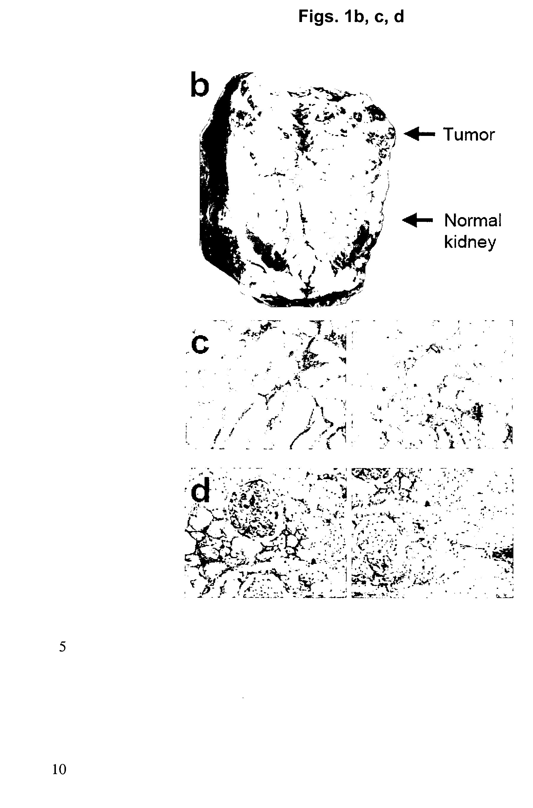 Vascular Tumor Markers