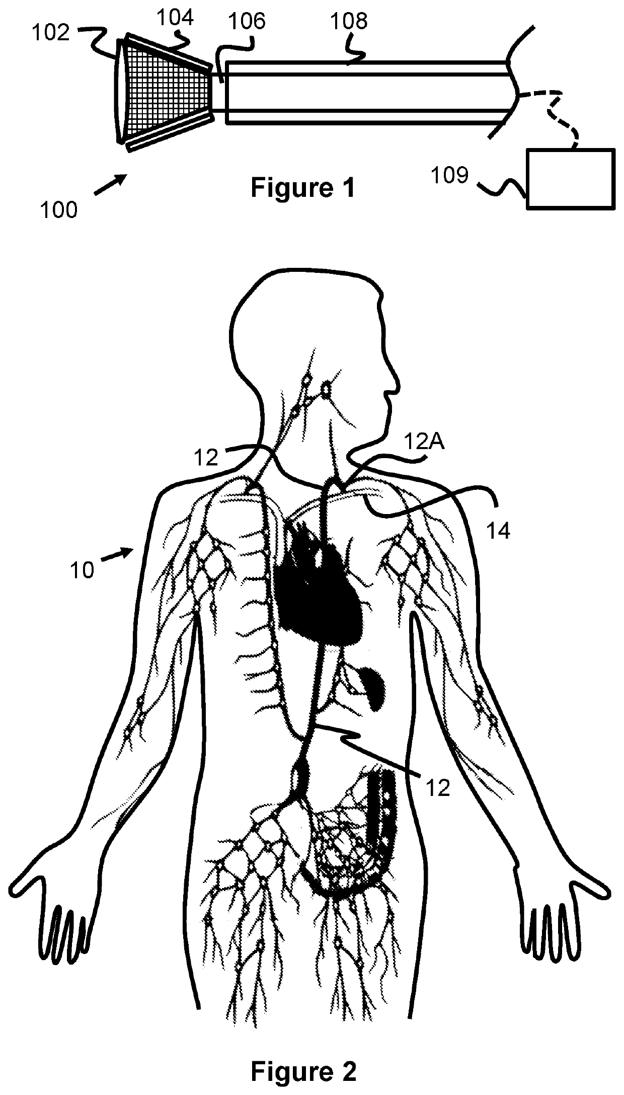 System And Method For Treatment Via Bodily Drainage Or Injection