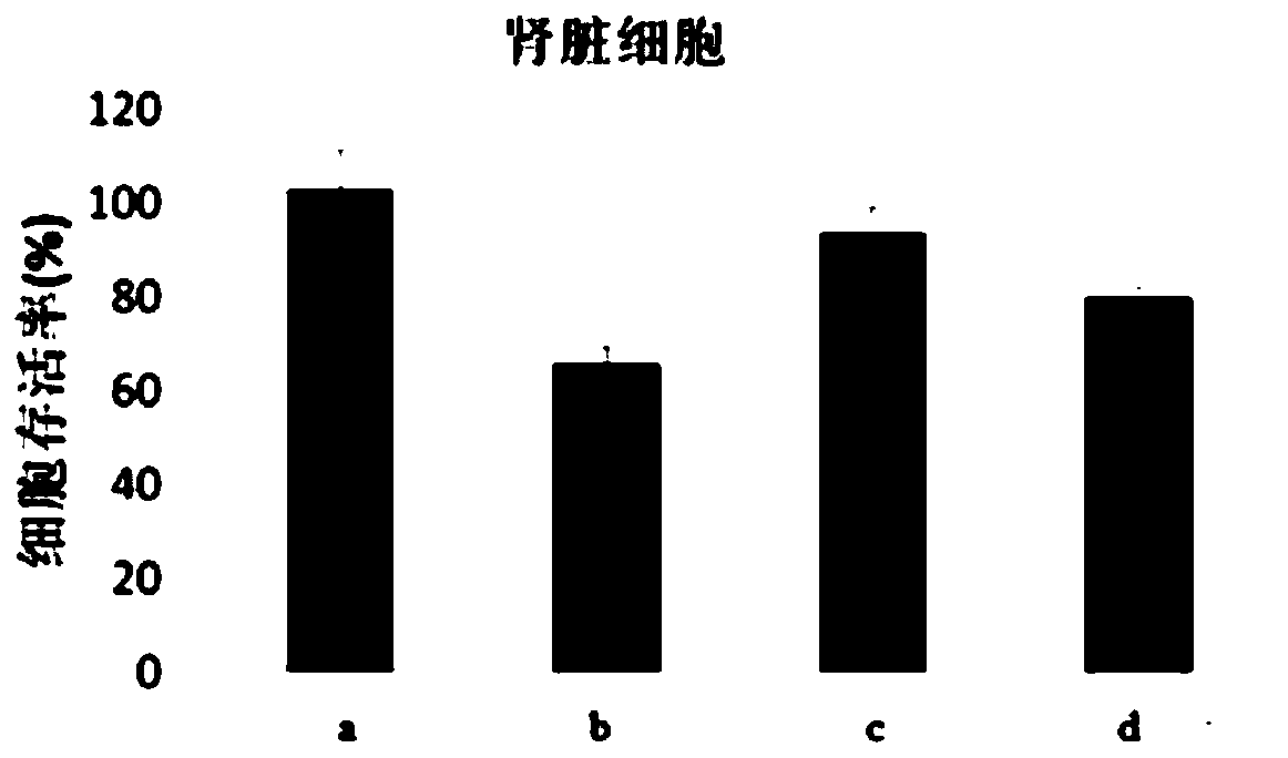 Liposome complex not penetrating blood-brain barrier and preparation method thereof