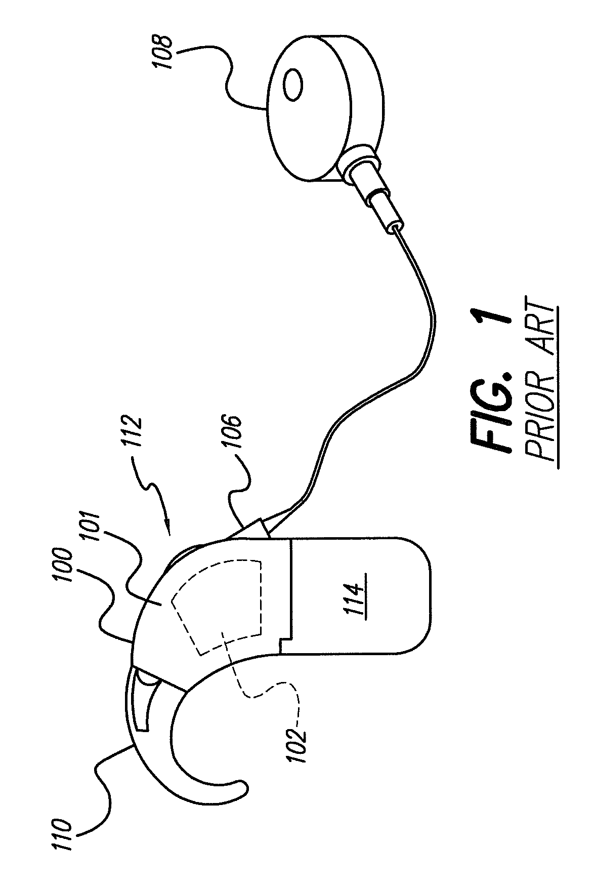 Methods of converting a behind-the-ear speech processor unit into a body worn speech processor unit