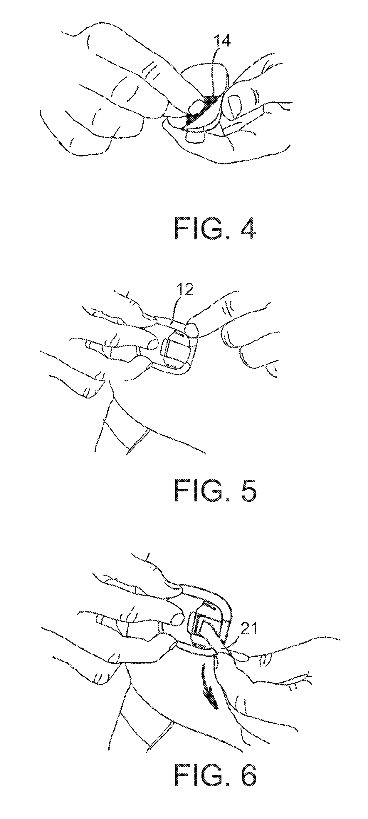 Medical Skin Mountable Device