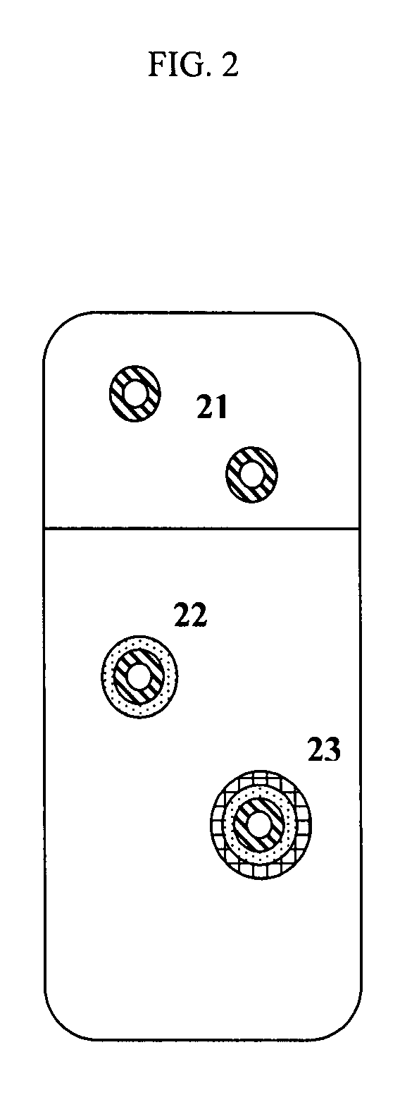 Dosage forms for movement disorder treatment