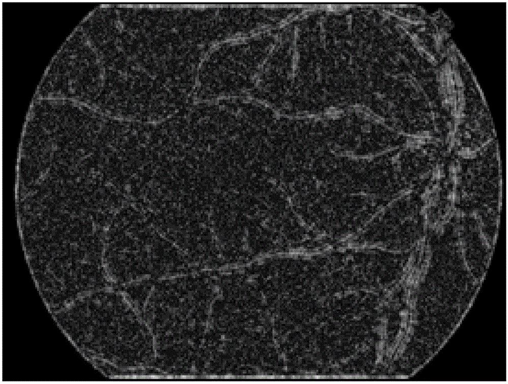 Gradient vector analysis-based retinal image micro-aneurysm automatic detection and identification method