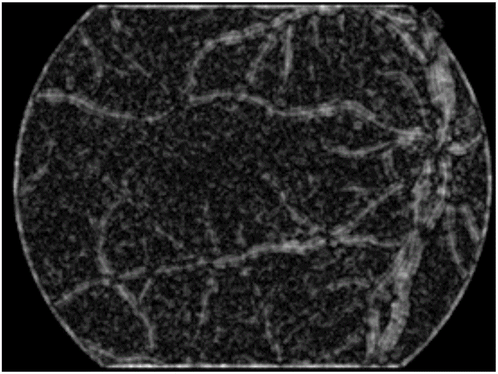 Gradient vector analysis-based retinal image micro-aneurysm automatic detection and identification method