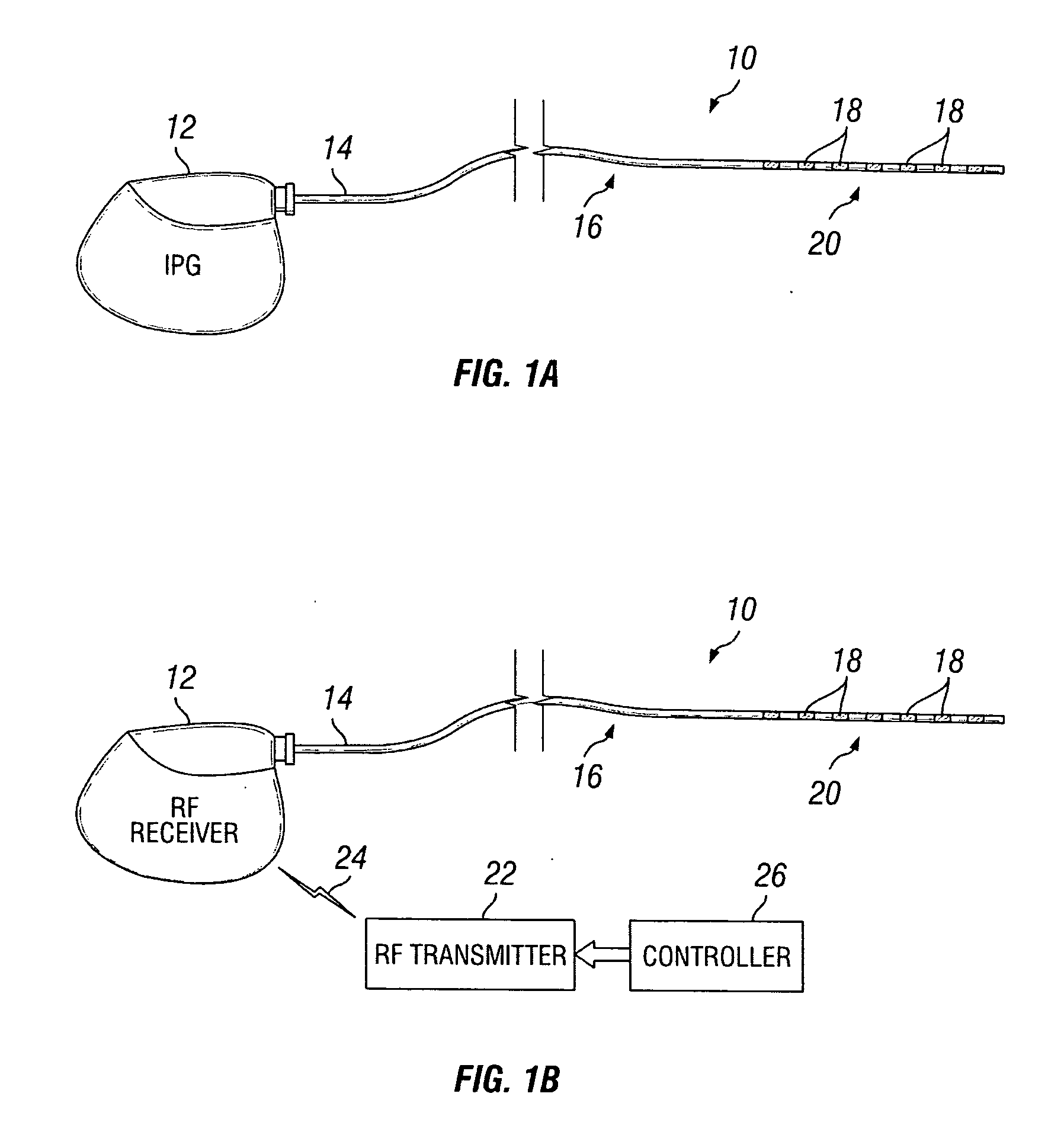 New stimulation design for neuromodulation