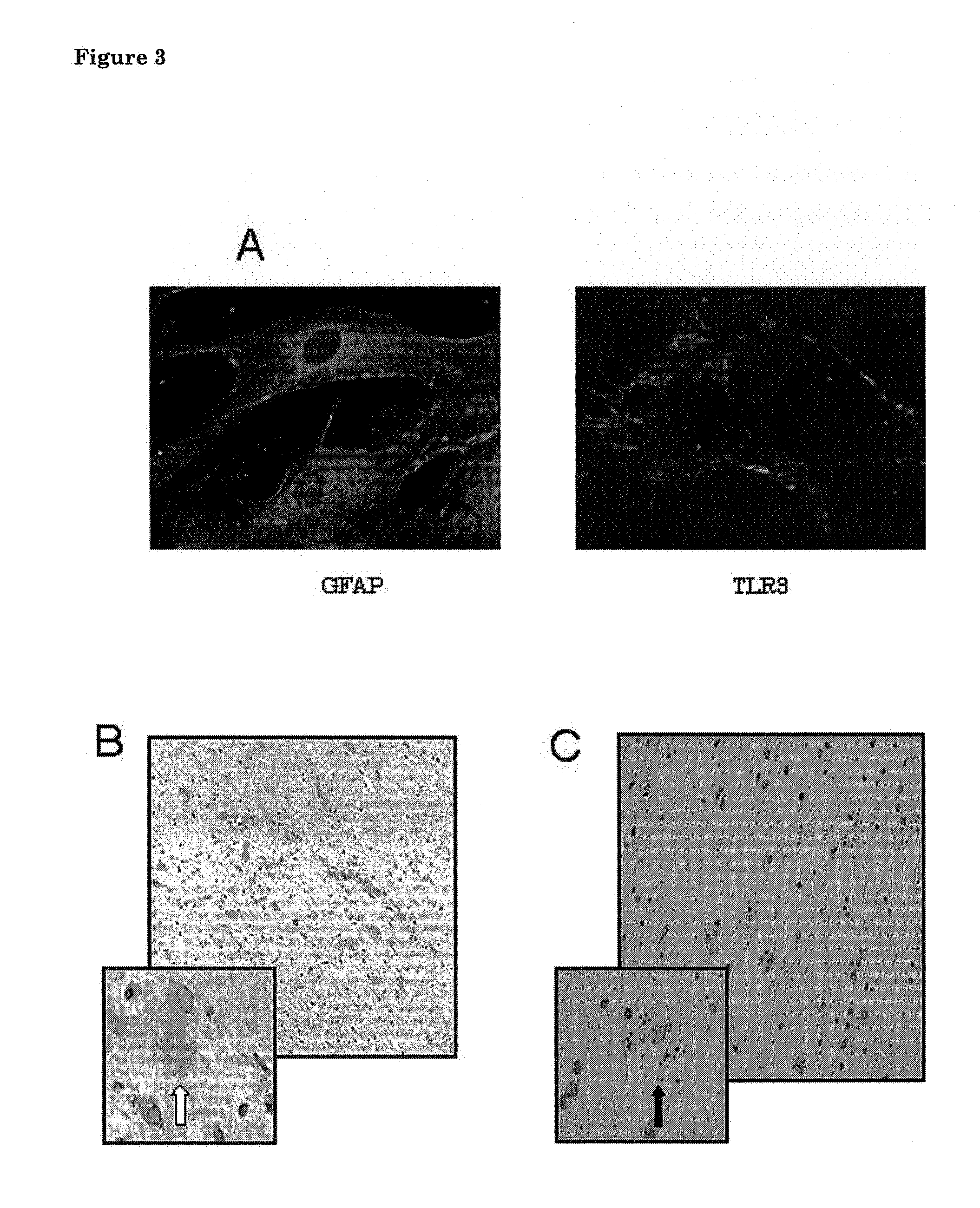 Use of tlr3 agonists for the treatment of neurodegenerative disorders